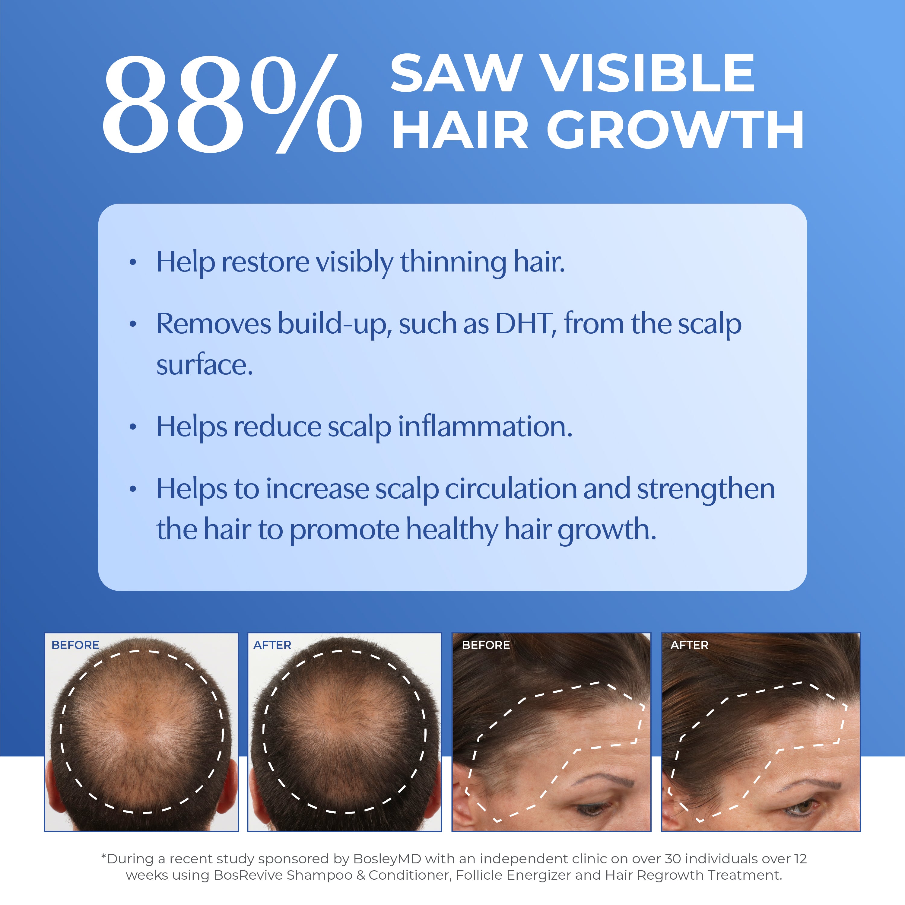 88% saw visible hair growth with before and after images of a man and a woman.