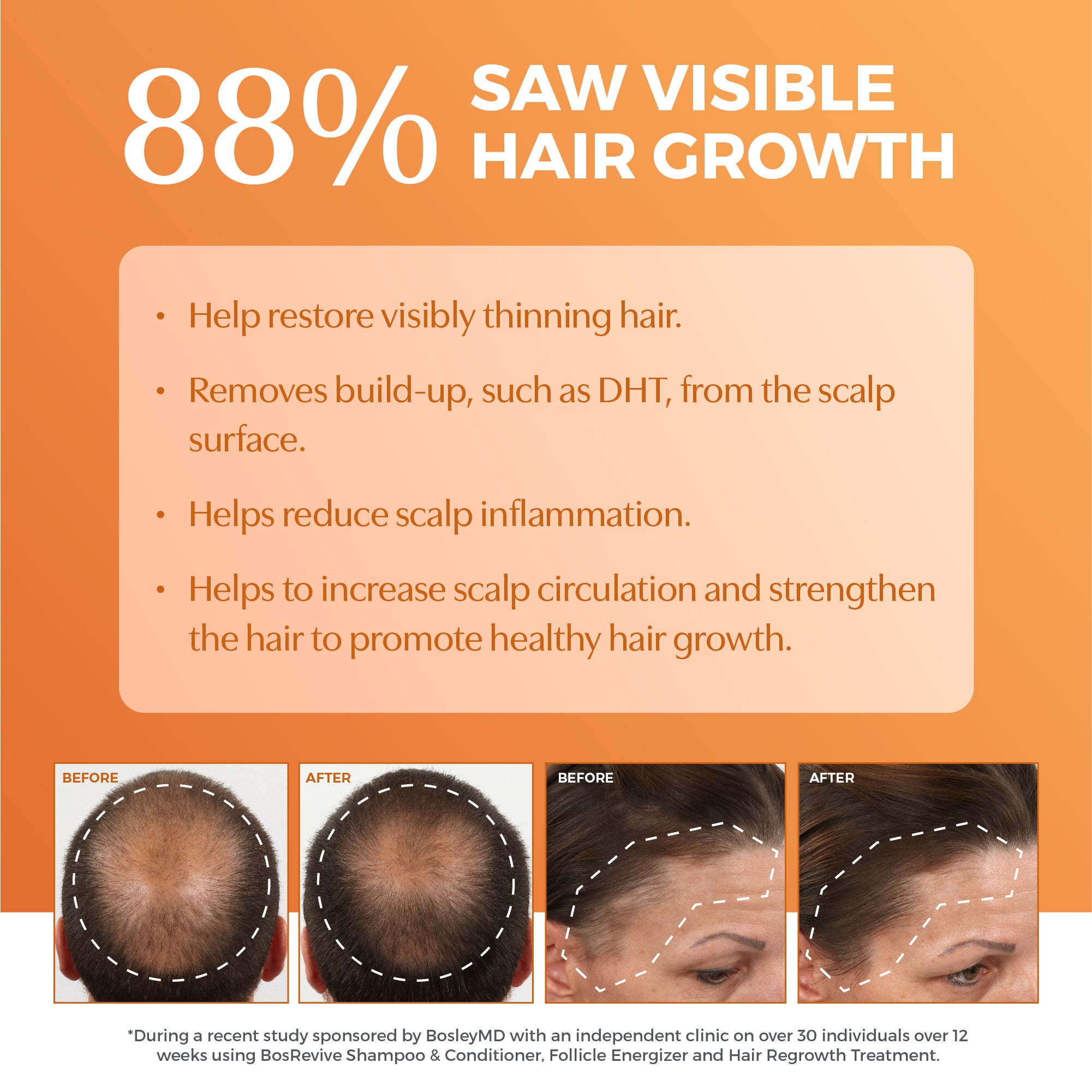 88% saw visible hair growth. Before and after images.