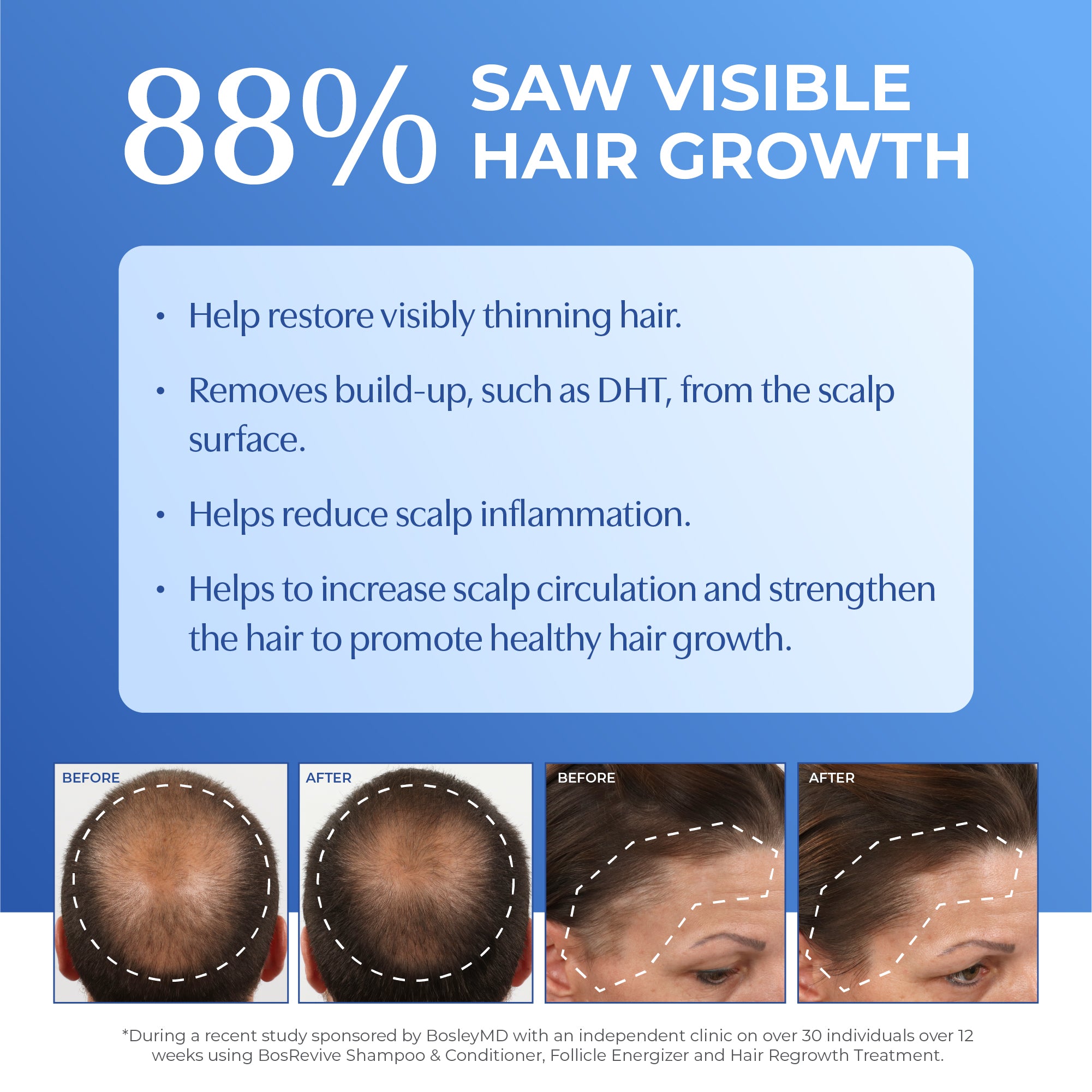 88% saw visible hair growth. Before and after images.